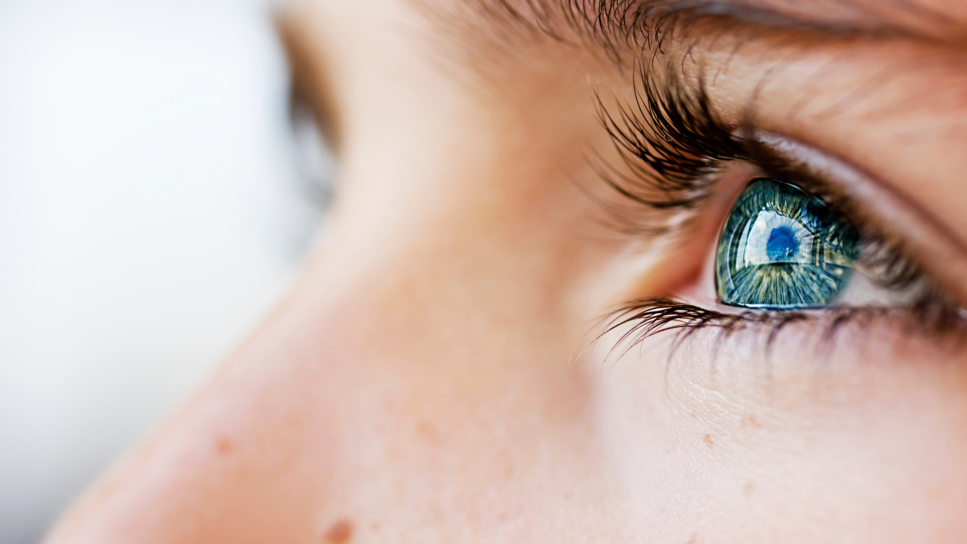 Contacter OculoVision